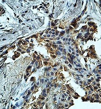 DUSP10 Rabbit Polyclonal Antibody