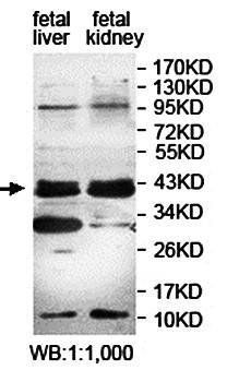 DUSP11 Rabbit Polyclonal Antibody