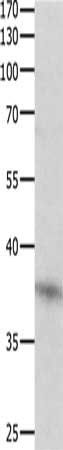 DUSP12 antibody