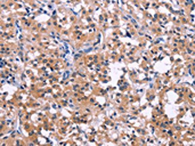 DUSP13 Antibody