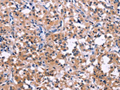 DUSP13 antibody