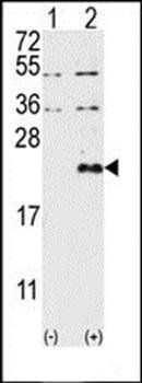 DUSP13-M1 antibody