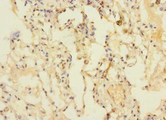 DUSP16 Antibody