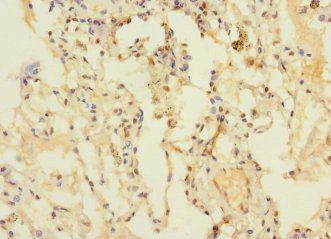 DUSP16 antibody