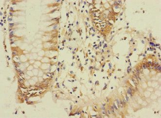 DUSP16 Antibody