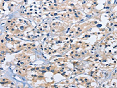 DUSP19 Antibody