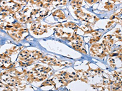 DUSP19 Antibody
