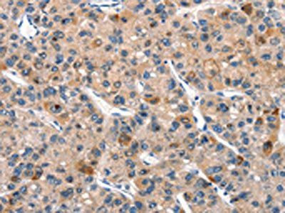 DUSP2 Antibody