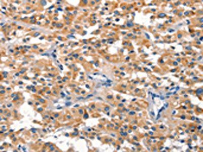 DUSP2 Antibody