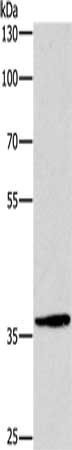 DUSP2 antibody