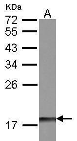 DUSP26 antibody [N1C1]