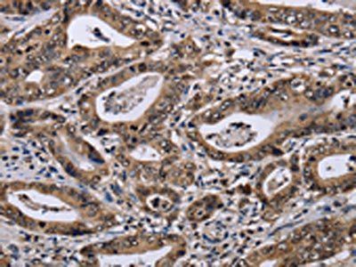 DUSP4 Antibody