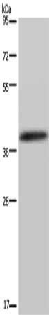 DUSP4 antibody