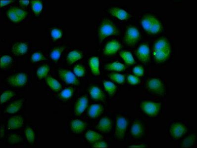 DUSP6 Antibody
