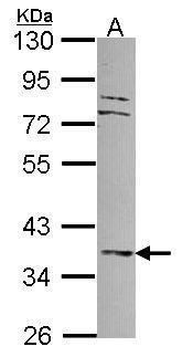 Adenylate kinase 4 antibody [N1C3]