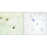 DUSP6 Antibody