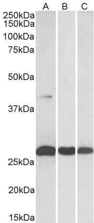 Goat anti-DUSP6 / MKP3 Antibody