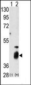 DUSP7 antibody