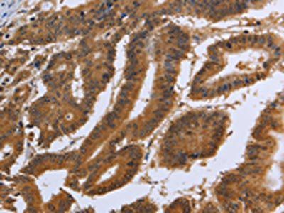 DUSP8 Antibody