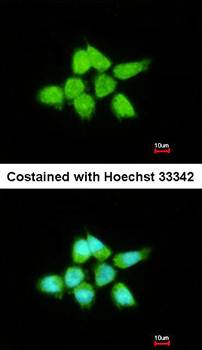 DUSP8 antibody