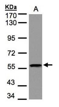 DUSP8 Rabbit Polyclonal Antibody