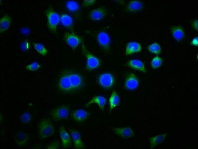 DVL2 Antibody