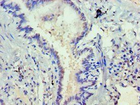 DVL2 Antibody