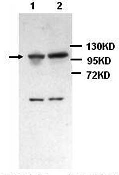 DDX58 Rabbit Polyclonal Antibody