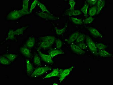 DXO Antibody
