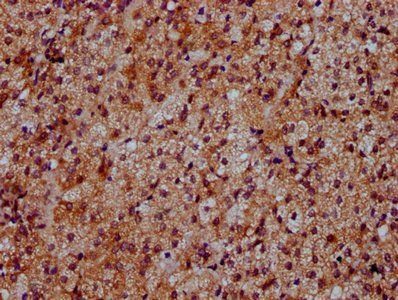 DYM Antibody