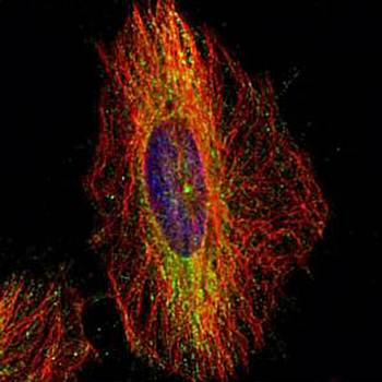 dynactin 1 Rabbit Polyclonal Antibody