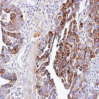dynactin 1 Rabbit Polyclonal Antibody