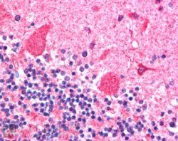 Goat anti-Dynactin Antibody
