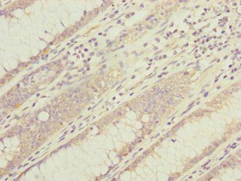 DYNC1I1 Antibody