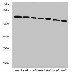 DYNC1I1 Antibody