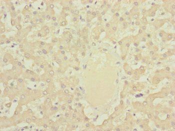 DYNC2LI1 Antibody