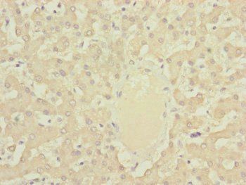 DYNC2LI1 antibody