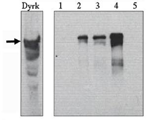 Sheep anti Mouse Dyrk (Downs Syndrome critical region) Antibody