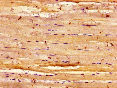 DYSF Antibody