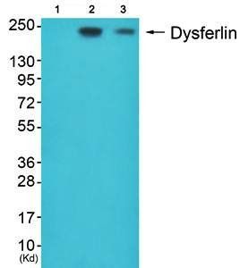 Dysferlin antibody