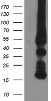 DTNA Antibody