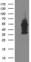DTNA Antibody