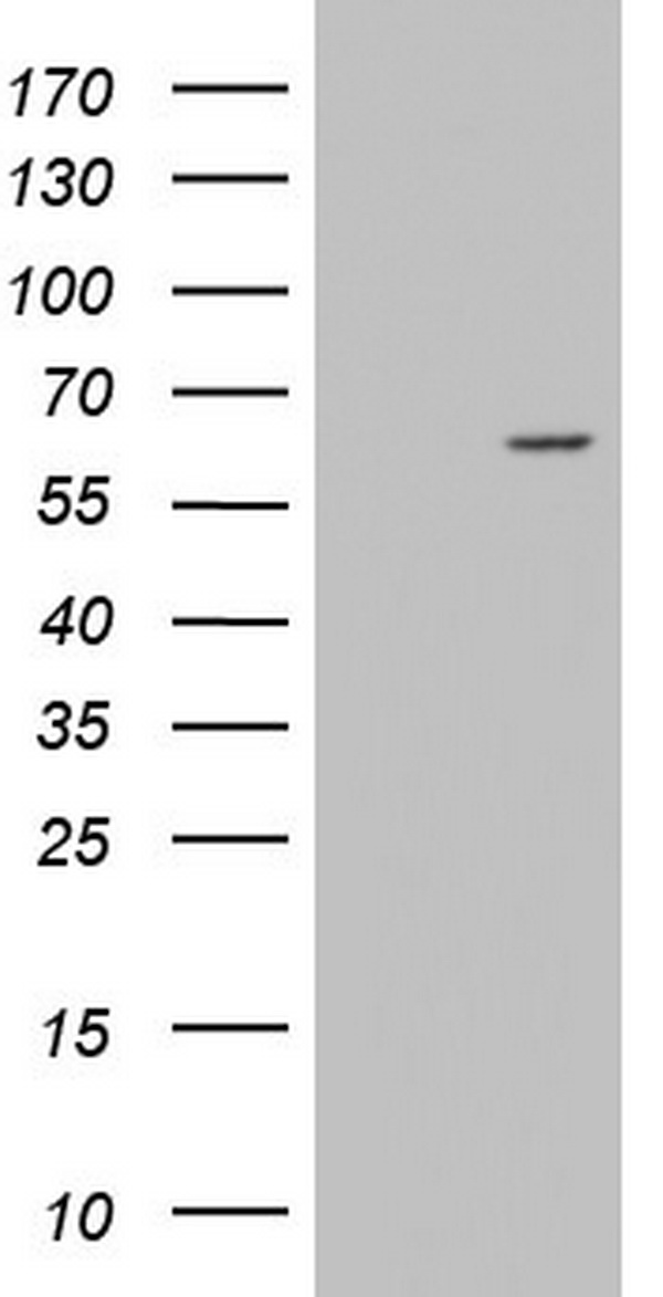 E Cadherin Antibody