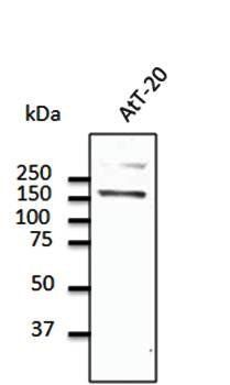 CDH1 Antibody