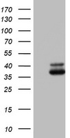 E-Cadherin(CDH1) Antibody