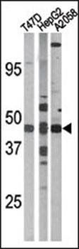 E2F1 (phospho-Ser337) antibody