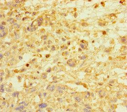 E2F1 antibody