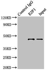 E2F1 antibody