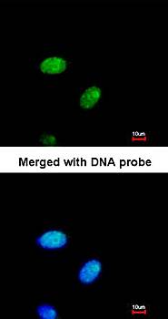 E2F1 Rabbit Polyclonal Antibody