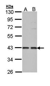 E2F1 Rabbit Polyclonal Antibody